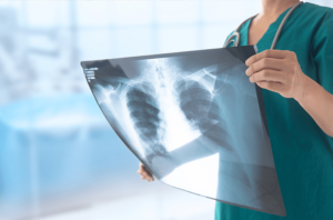 Ingyenes mellkas röntgen kampány - 2024 március - Medical Center Hatvan
