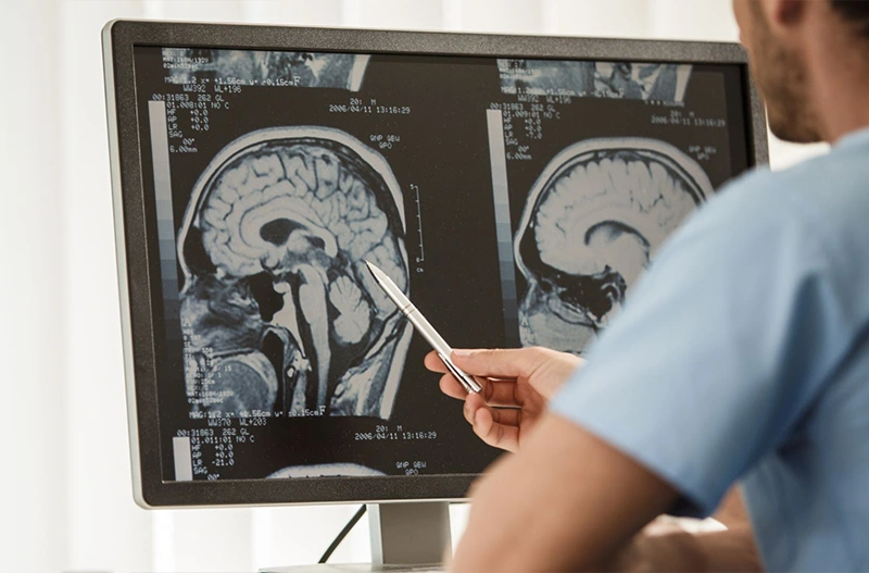 Mikor érdemes idegsebészhez fordulni? – MC60